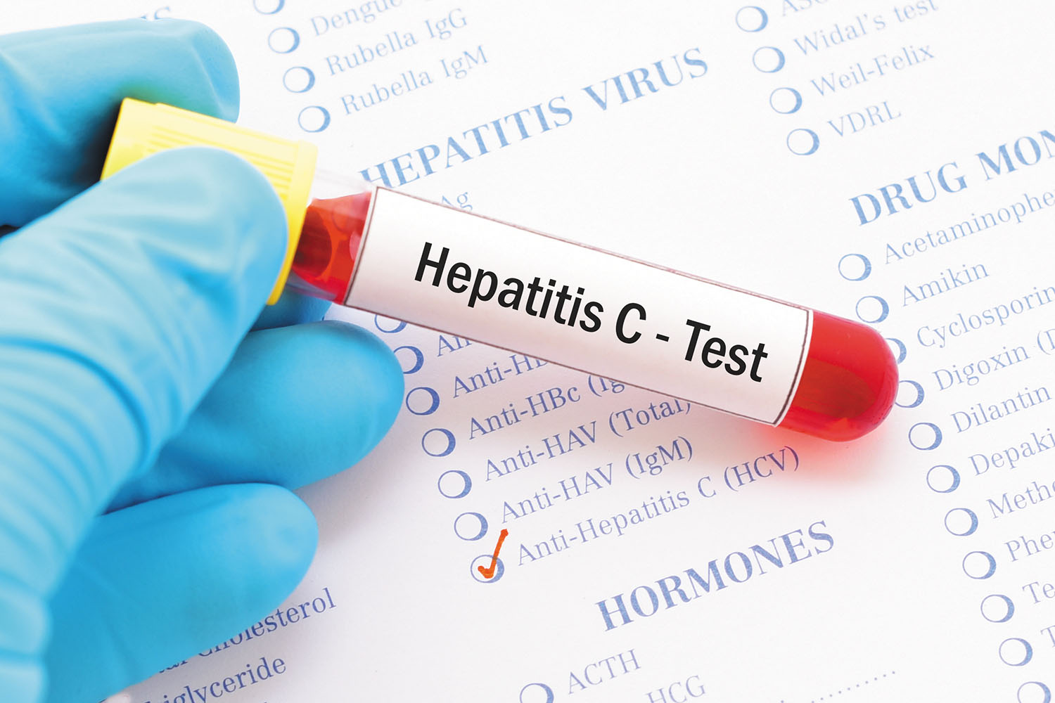 Hepatitis C test